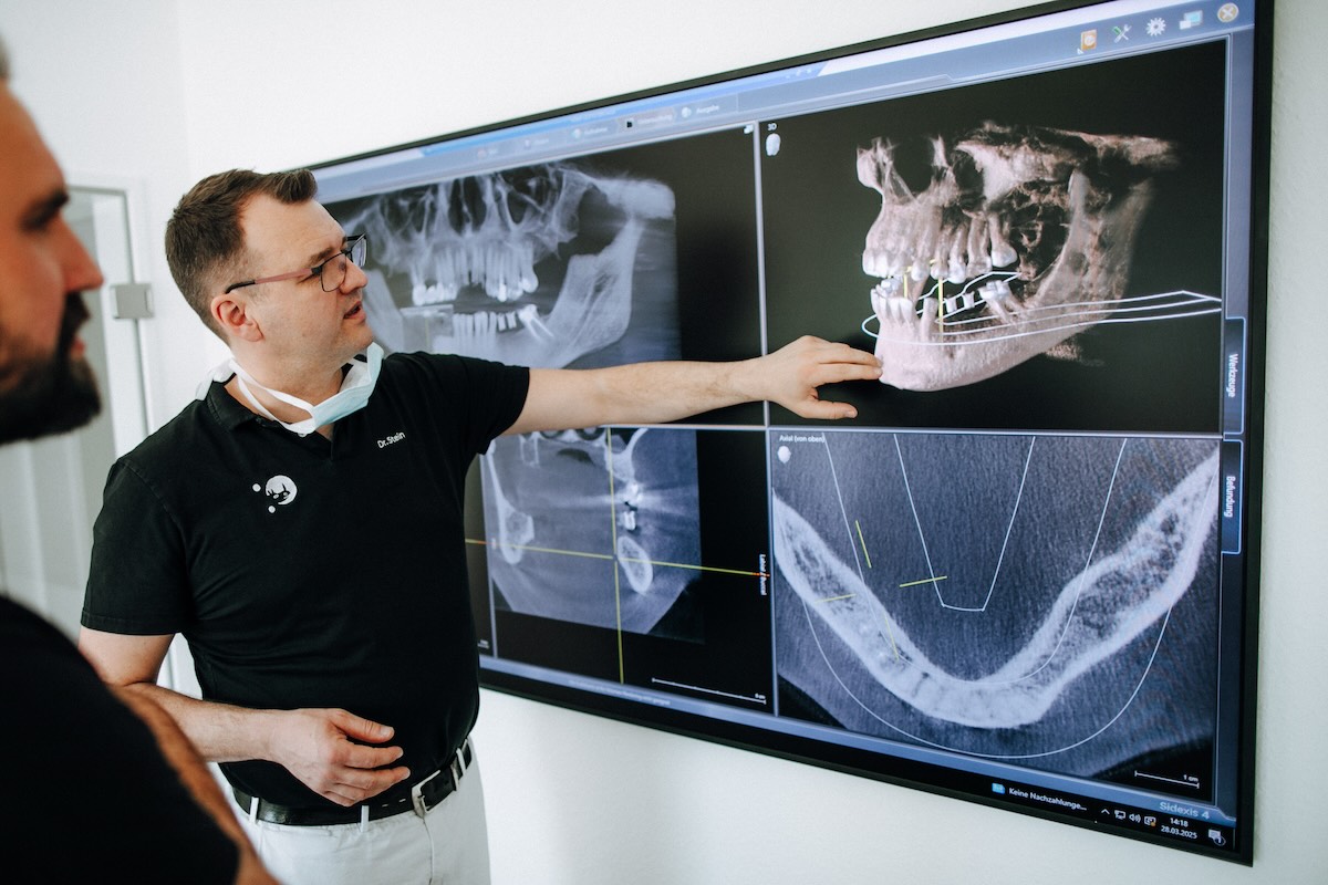 Digitale 3D-Implantatplanung mit DVT-Aufnahme in Dortmund
